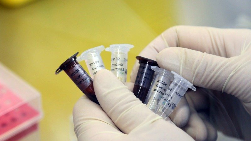 美国以机器人治疗武汉肺炎患者 传染风险减至最低 (图)