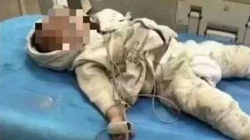 江苏婴儿异物卡喉送急诊  医等PCR拖8小时不救亡 (图/视频)