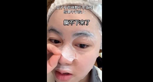 一名贵州女子表示自己发高烧敷补水面膜,结果面膜竟被“烧干”在脸上撕不下来。(图片来源:视频截图)