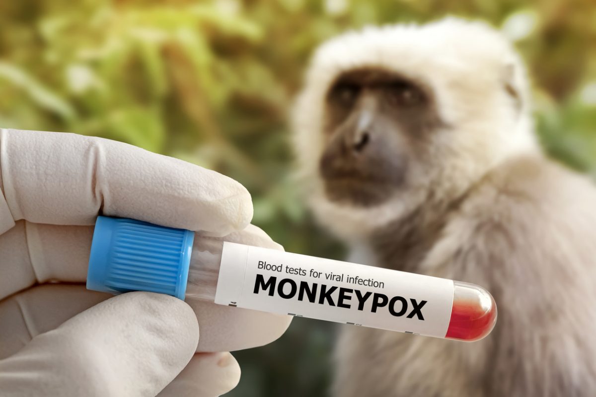 目前尚无特异性抗猴痘病毒药物,主要是对症支持和并发症的治疗。(图片来源:网络截图)